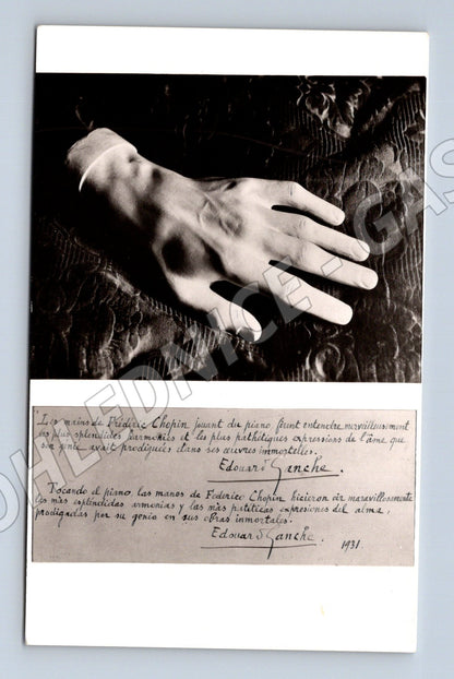 Pohlednice Mallorca Valldemossa ruka Fryderyka Chopina (M15819)